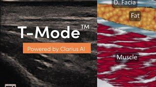 T-Mode™ AI for Aesthetics