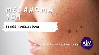 What is Stage I Melanoma?