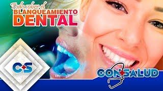 BLANQUEAMIENTO DENTAL