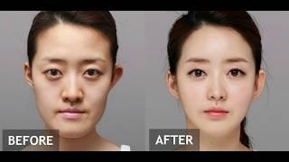 Why is Korea the plastic surgery Capital of the World?
