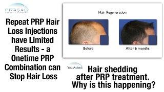 Repeat PRP Hair Loss Injections can Cause Hair Shedding Similar to Shock Loss in Hair Transplants