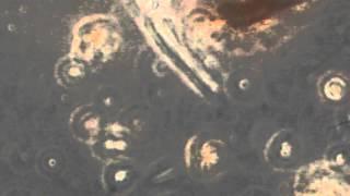 KIS Organics Biochar Soil + Molasses 28 hrs under the microscope
