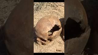 Artillery headshot - soldier's bodies found with shrapnel fragments still in their skulls