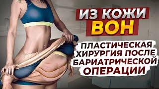 Обвисла кожа после бариатрической операции  • ЧТО ДЕЛАТЬ? • Пластическая операция после бариатрии