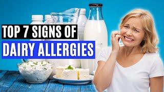 Top 7 Signs of a Dairy Allergy (Signs of CMPA)