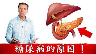 (糖尿病原因) 胰臟長脂肪導致糖尿病!自然療法,柏格醫生 Dr Berg