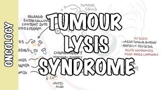 Tumour Lysis Syndrome (Tumor Lysis Syndrome) - pathophysiology, diagnosis and treatment