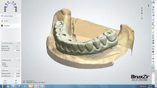 CAD/CAM Tools Tips & Tricks BruxZir Full-Arch Implant Prosthesis Design (Vol. 1, Issue 3)