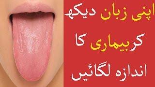 9 Secrets Your Tongue Reveals About Your Health | Life Skills TV