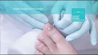 Hilfe für nahezu jeden Problemnagel - RUCK® NAGELKORREKTUR -   GOLDSTADT professional (Klebespange)