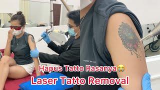 HAPUS TATTO WARNA | Laser Tatto Removal #lasertattooremoval #hapustatto