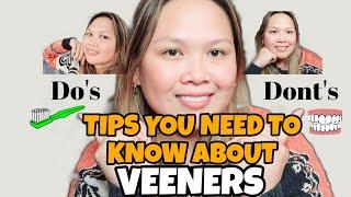 Do' s and Dont's about Veeners||The tips and how to take care of your Veeners