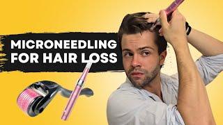 How to Microoneedle for Hair Loss (Step-by-Step Guide) | Derma Roller vs. Derma Pen