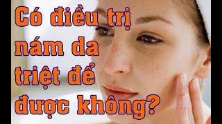 Có Điều Trị Nám Da Triệt Để Được Không? SKĐS