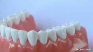 Correct Brushing Technique Animation by Dr Jignesh Mehta