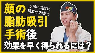 【顔脂肪吸引】 小顔になるために受けた脂肪吸引手術！より早めに効果を得られる方法とは⁈　#小顔効果  #顔脂肪吸引 ＃高周波管理