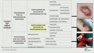 Medicina legal - Lesionologia