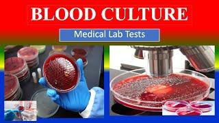 BLOOD CULTURE -   Medical  Lab Tests -  What is ? , Uses , Need , Preparation , Results