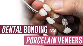 Dental Bonding vs Porcelain Veneers - Which Should I Get?