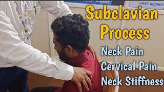 Subclavian Point in Neurotherapy for #Subclavian #Cervicalstiffness #Jointspain #Nawalsir 9718425042