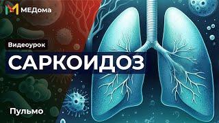 Саркоидоз легких: Патогенез, Симптомы, Лечение и Диагностика | Медома | Подготовка к USMLE Step 1