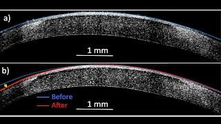 ‘Molecular surgery’ reshapes living tissue with electricity but no incisions