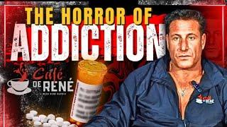 How Rene Dupree Got ADDICTED To Pain Killers