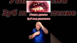 Не чистишь зубной камень? Смотри что будет! #лечениезубовмосква #зубнойкамень