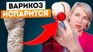 Варикоз. 8 упражнений за 10 минут. Избавление без операции. Полное видео.