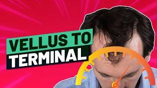 Vellus Hair to Terminal Hair - How to Speed It Up!