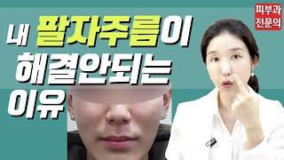 (*Eng) 팔자주름 필러 제발 좀 조심하세요! 전후사진 Nasolabial fold (smile lines) filler - 피부과전문의 [닥터필러]