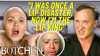 REJECTED by Botched: 'Lip King' Jordan Is BACK After More Extreme Plastic Surgery | Botched | E!