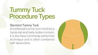 Tummy Tuck: Benefits, Types and Recovery | Marin Aesthetics