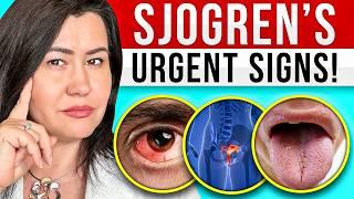 10 Signs of Sjogren's Syndrome - a very complex autoimmune disease