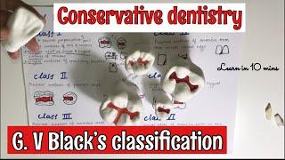 G. V. BLACK’S CLASSIFICATION OF TOOTH PREPARATION || CONSERVATIVE DENTISTRY || *imp