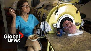 ‘Iron Lung Man’ dies at 78 after more than 70 years of paralysis from polio