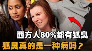 狐臭是一种病吗？为什么西方人80%有狐臭，东亚人却很淡雅清新？