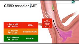 GERD - Endoscopic Evaluation - Bravo Test