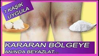 1 Kaşık Uygula Cilt Kararmalarını Anında Beyazlat|Koltuk Altı-Diz-Bikini bölgesi Kararmasına Çözüm