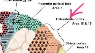 Occipital Lobe Epilepsy: Extra Striate Cortex