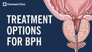 Treating Benign Prostatic Hyperplasia (BPH)