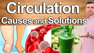 POOR CIRCULATION AND VARICOSE VEINS NEVER AGAIN -Its Causes and Solutions -Improve Blood Circulation