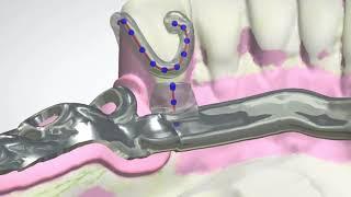 3DBioCAD - 3Shape Dental System RPD Design