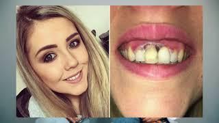 The ugly truth about Illegal Teeth Whitening  Dr. Rhona Eskander shares illegal Whitening Facts!