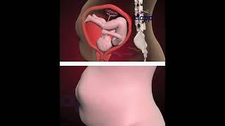 baby struggling  Inside the Womb to survive (3D Animation)