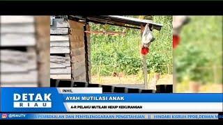 A-R PELAKU MUTILASI HIDUP KEKURANGAN