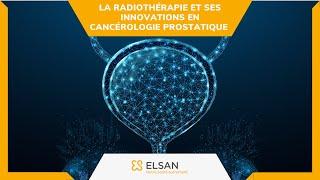 Cancer de la prostate :  la radiothérapie et ses innovations en cancérologie prostatique