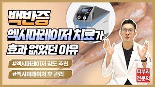 백반증 엑시머 레이저 효과 높이는 법, 이렇게만 따라하시면 됩니다.