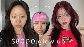 $8000 EXTREME glow up in Korea (Plastic surgery, skin clinic, hair, nail, profile pic, idol makeup)