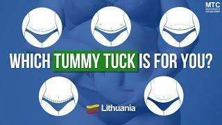 Choosing the Right Tummy Tuck in Lithuania: Your Complete Guide!